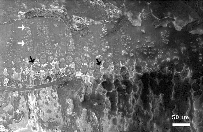Figure 1. Cryo-SEM block-face micrograph of a mouse tibia showing the growth plate chondrocytes (white arrows) and the mineralization front (black arrows). 